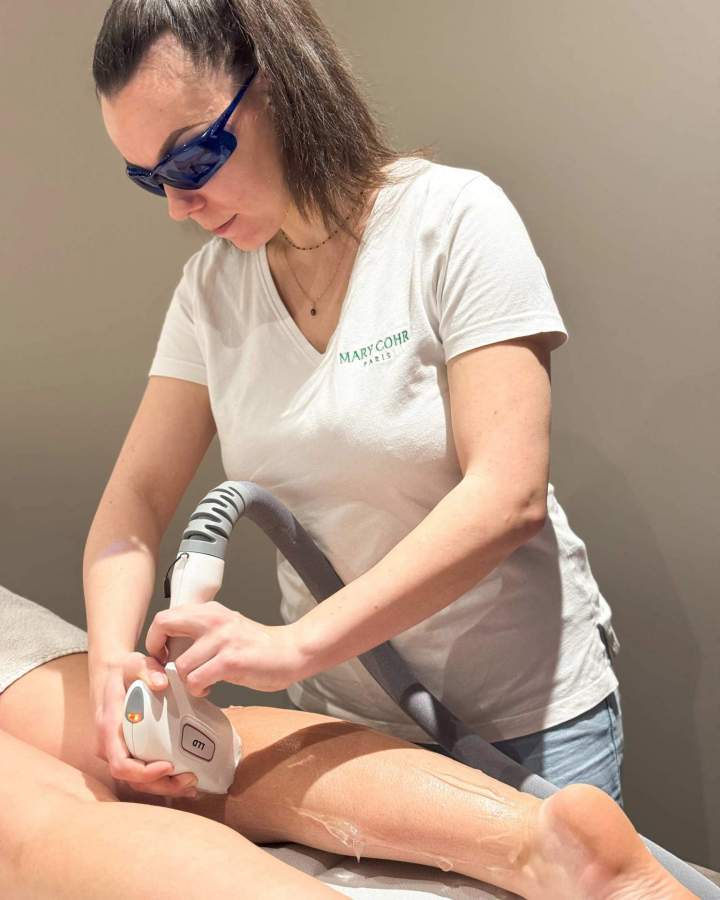 Épilation définitive laser LEMPDES